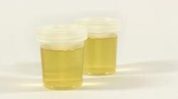 Poder do xixi: cientistas usam urina humana para carregar celular 4