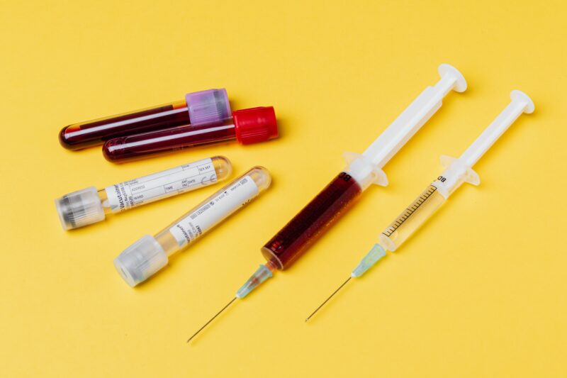Exame de Sangue para detectar Alzheimer está próximo de chegar ao público 4