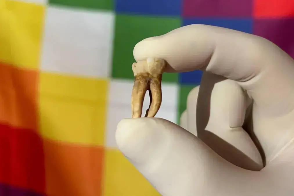 Bactéria causadora da hanseníase já circulava nas Américas antes da chegada dos europeus