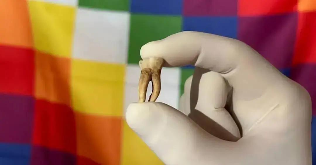 Hanseníase já existia nas Américas antes da chegada dos europeus, revela estudo